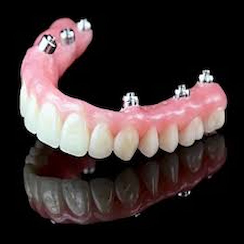 تصویر 1 از قیمت خرید دندان مصنوعی ژله ای تکی + فروش ویژه